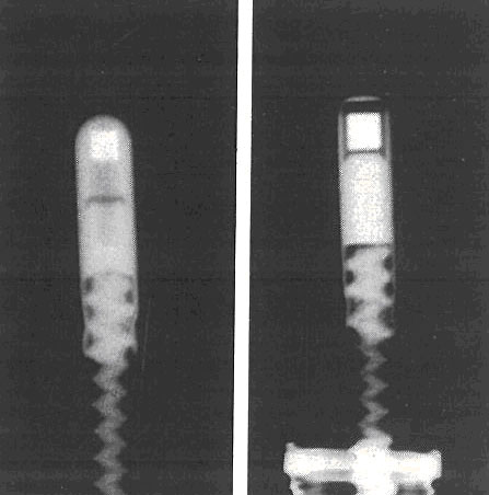 Testing Engineers Case Study on Gamma Radiography